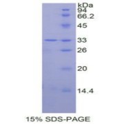 SDS-PAGE analysis of Human MAPK14 Protein.