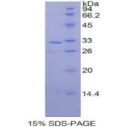 SDS-PAGE analysis of Human MAPK9 Protein.