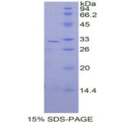 SDS-PAGE analysis of Human MAP2K3 Protein.