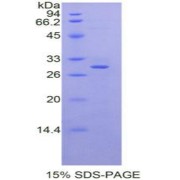 SDS-PAGE analysis of Rat Moesin Protein.