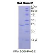 SDS-PAGE analysis of Rat Smad1 Protein.