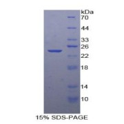 SDS-PAGE analysis of Human Smad3 Protein.