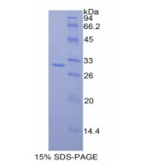 SDS-PAGE analysis of Mouse MAdCAM1 Protein.