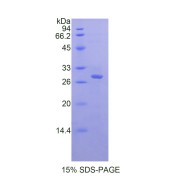 SDS-PAGE analysis of recombinant Mouse MyD88 Protein.