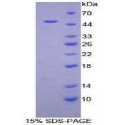 SDS-PAGE analysis of Human Myoglobin Protein.