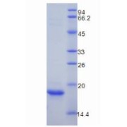 SDS-PAGE analysis of Mouse Myoglobin Protein.