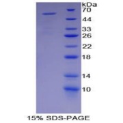 SDS-PAGE analysis of recombinant Mouse MYH2 Protein.