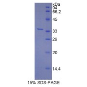 SDS-PAGE analysis of Rat MYH3 Protein.