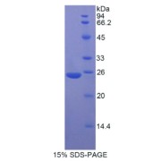 SDS-PAGE analysis of Rat MYH8 Protein.