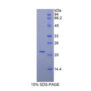 SDS-PAGE analysis of Human MYL3 Protein.