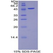 SDS-PAGE analysis of Rat MYL6B Protein.