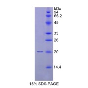 SDS-PAGE analysis of Human MYL9 Protein.