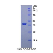 SDS-PAGE analysis of Mouse MYLK Protein.