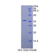 SDS-PAGE analysis of Mouse MYLK4 Protein.