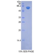 SDS-PAGE analysis of Mouse NAGLU Protein.