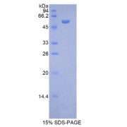 SDS-PAGE analysis of Rat NAGLU Protein.