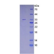 SDS-PAGE analysis of recombinant Human MGEA5 Protein.