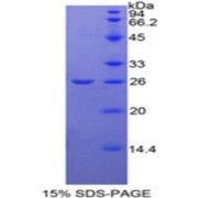 SDS-PAGE analysis of Rat NAGase Protein.