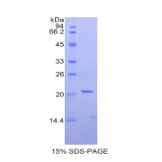 SDS-PAGE analysis of Rat NAGase Protein.