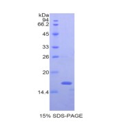 SDS-PAGE analysis of Mouse NAGase Protein.