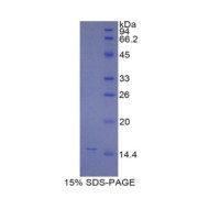 SDS-PAGE analysis of Mouse NAGase Protein.