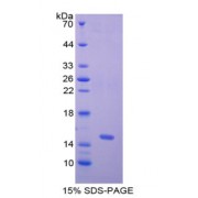 SDS-PAGE analysis of Human Nephrin Protein.