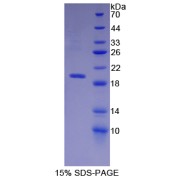 SDS-PAGE analysis of recombinant Human Neprilysin Protein.