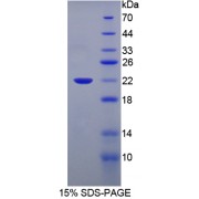 SDS-PAGE analysis of Human Neprilysin Protein.