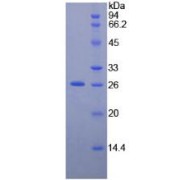 SDS-PAGE analysis of Human NEFM Protein.