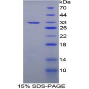 SDS-PAGE analysis of Mouse NAIP Protein.