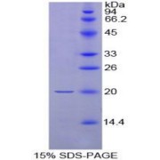 SDS-PAGE analysis of Rat Neurotensin Protein.