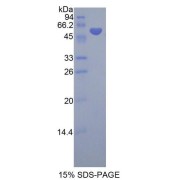 SDS-PAGE analysis of Human SMPD2 Protein.