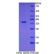 SDS-PAGE analysis of Mouse NCF2 Protein.