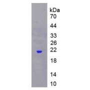 SDS-PAGE analysis of recombinant Dog NGAL Protein.