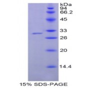 SDS-PAGE analysis of Human NNMT Protein.