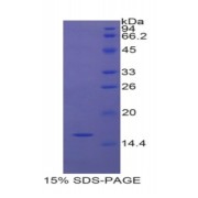 SDS-PAGE analysis of Rat NOS1 Protein.