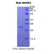 SDS-PAGE analysis of Rat NOS3 Protein.