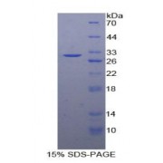 SDS-PAGE analysis of recombinant Human NOSIP Protein.