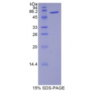 SDS-PAGE analysis of Rat Noggin Protein.