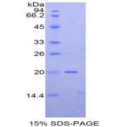 SDS-PAGE analysis of Mouse NME2 Protein.