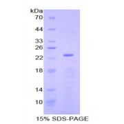 SDS-PAGE analysis of Mouse NME3 Protein.