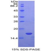 SDS-PAGE analysis of Human NME4 Protein.