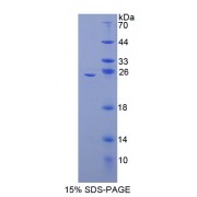 SDS-PAGE analysis of Mouse NFkB2 Protein.