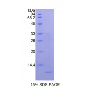 SDS-PAGE analysis of Human Nucleophosmin Protein.