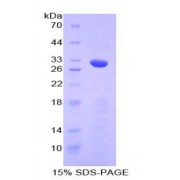 SDS-PAGE analysis of Mouse Numb Homolog Protein.