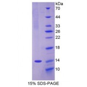 SDS-PAGE analysis of Rat Olfactomedin 4 Protein.