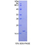 SDS-PAGE analysis of recombinant Mouse Oncomodulin Protein.