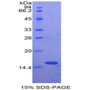 SDS-PAGE analysis of Rat Oncomodulin Protein.
