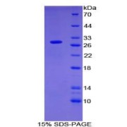 SDS-PAGE analysis of Human OIT3 Protein.