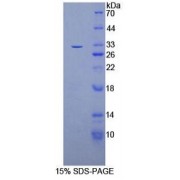SDS-PAGE analysis of recombinant Rat Oncostatin M Receptor Protein.